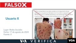 José Hiram Hernández, especialista en infectología que trató el caso confirmó a VOA que la fotografía data de 2022 de un paciente con VIH y mpox (viruela símica) y no de un daño por perdigones de un rifle en Irán como se dice en X.