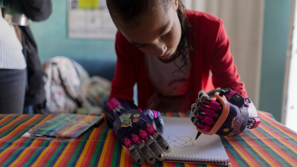 uruguay-foundation-prints-free-3d-prosthetic-hands-arms