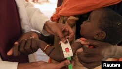 FILE - A health worker takes a measurement of 8-month-old Abdurahman Bishar, at a clinic for malnourished children, at the Higlo camp for people displaced by drought, in the town of Gode, Somali Region, Ethiopia, April 26, 2022. Pictures taken April 26, 2022. 