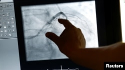 Sebuah monitor kontrol terlihat selama kateterisasi jantung di Rumah Sakit Universitas Heidelberg, Jerman (foto: ilustrasi).