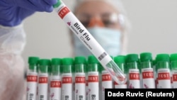 FILE - A person holds a test tube labeled "Bird Flu", in this picture illustration, January 14, 2023. (REUTERS/Dado Ruvic/Illustration/File Photo)