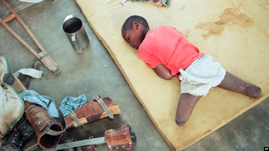 FILE - A young orphan, his legs amputated below the knee, rests on a foam cushion near his artificial limbs at an orphanage in Nyanza, about 35 miles southwest of the capital Kigali, Rwanda, June 9, 1994.