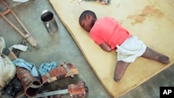 FILE - A young orphan, his legs amputated below the knee, rests on a foam cushion near his artificial limbs at an orphanage in Nyanza, about 35 miles southwest of the capital Kigali, Rwanda, June 9, 1994.