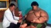 Seorang dokter memeriksa kondisi Arya, anak berusia 10 tahun yang mengalami obesitas, di rumahnya di Karawang, pada 1 Juli 2016. (Foto: AFP/Mahendra)