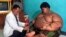 Seorang dokter memeriksa kondisi Arya, anak berusia 10 tahun yang mengalami obesitas, di rumahnya di Karawang, pada 1 Juli 2016. (Foto: AFP/Mahendra)