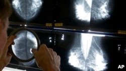 FILE - A radiologist uses a magnifying glass to check mammograms for breast cancer in Los Angeles, May 6, 2010.