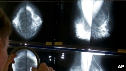 FILE - A radiologist uses a magnifying glass to check mammograms for breast cancer in Los Angeles, on May 6, 2010.