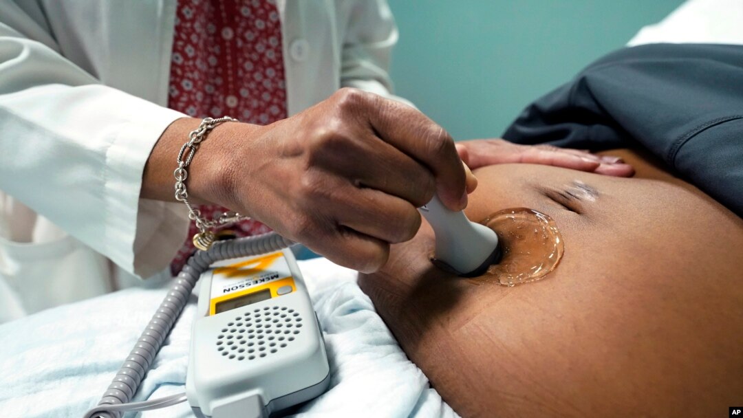 ILUSTRASI - Seorang dokter menggunakan alat Doppler genggam untuk mengukur detak jantung janin pada pada seorang ibu hamil di Jackson, Miss, 17 Desember 2021.(AP/Rogelio V. Solis, File)