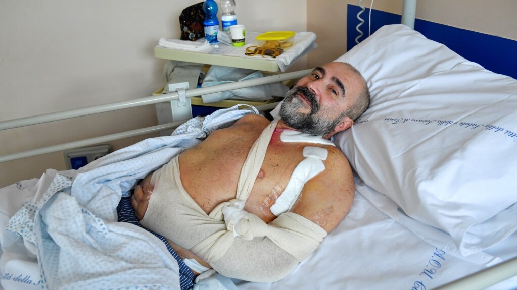 Italian Man Might Regain Use of Hand after Nerve Operation