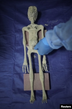 Anthropologist Roger Zuniga of the San Luis Gonzaga National University shows a dried, fossilized body he says was found near the Nazca Lines at a private clinic, in Ica, Peru, Jan. 17, 2024.