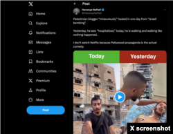 A screen capture from X. This post actually shows two different people (Saleh Aljafarawi, 25, left, and Saeed Zandek, 16, right) and were taken months apart, despite claims it's a "Pallywood" fake.