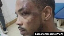 Farid Michel Tavares Fadul (Cuca Fadul), deputado do PRS, espancado em Bissau, Guiné-Bissau.