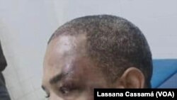 Farid Michel Tavares Fadul (Cuca Fadul), deputado do PRS, espancado em Bissau, Guiné-Bissau.