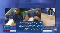 |هشدار: تصاویر ناراحت‌کننده| جراحی مخفیانه ایوب غیبی‌پور، زندانی سیاسی در اهواز 