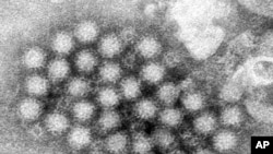 This electron microscope image provided by the Centers for Disease Control and Prevention shows a cluster of norovirus virions. On Feb. 29, 2024, the CDC said cases of norovirus, a nasty stomach bug, are climbing in the Northeastern U.S. (CDC via AP)