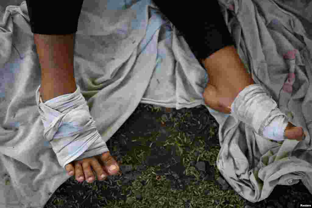 A migrant woman who is seeking to reach the U.S. border rests with her bandaged feet outside the &quot;Decanal Guadalupano&quot; migrant shelter in Tierra Blanca, Mexico, before continuing her journey through Mexico, Jan. 24, 2024.