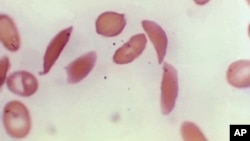 FILE - This photo provided on Oct. 25, 2023 by the Centers for Disease Control and Prevention shows crescent-shaped red blood cells from a sickle cell disease patient in 1972. (Dr. F. Gilbert/CDC via AP, File )
