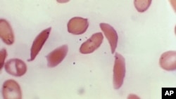 FILE - This microscope photo provided on Oct. 25, 2023, by the Centers for Disease Control and Prevention shows crescent-shaped red blood cells from a sickle cell disease patient in 1972. 
