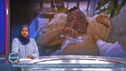 Gaza: Qisada xanuunka badan ee Cumar oo 4 jir ah.