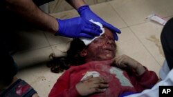 A Palestinian girl wounded in the Israeli bombardment of the Gaza Strip is treated in a hospital in Deir al-Balah, Nov. 14, 2023. 