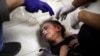 Seorang anak Palestina yang terluka akibat pengeboman di Jalur Gaza sedang dirawat di Rumah Sakit Nasser di Khan Younis, bagian selatan Jalur Gaza, Sabtu, 6 Januari 2024. (Foto: Mohammed Dahman/AP Photo)
