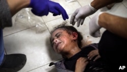 Palestinsko dijete ranjeno tokom izraelskog bombardiranja pojasa Gaze na liječenju je u bolnici Nasser u Khan Younisu, južni pojas Gaze, 6. januara 2024.