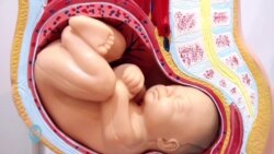 Fistula ya uzazi inaathiri wanawake kati ya 50,000 hadi laki moja duniani