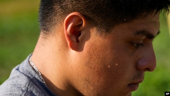 Sweat drips down the cheek of Brayan Manzano as he works, July 7, 2023, at a farm in Waverly, Ohio.