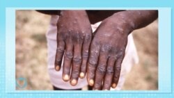 Healthy Living: Addressing the Mpox outbreak