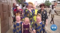 Africa's rising heat threatens people living with albinism