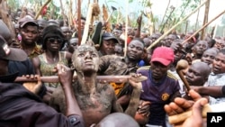 Daniel Wabuyi reacts during his traditional circumcision ritual, known as Imbalu, at Kamu village in Mbale, Eastern Uganda, Aug. 3, 2024. 