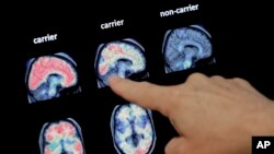 FILE - In this Aug. 14, 2018 file photo, a doctor looks at a PET brain scan at the Banner Alzheimers Institute in Phoenix. (AP Photo/Matt York, File)
