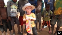 FILE - A 3-year-old boy with albinism is seen with his friends at their family home in this May, 23, 2016, photo in Machinga, Malawi.