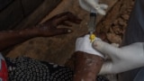 Paciente com mpox recebe tratamento intravenoso em hospital em Bukavu, RDC 24 agosto 2024