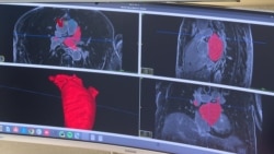 Peneliti Pakai AI untuk Skrining Penyakit Jantung dan Kanker
