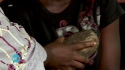UN Concerned Over Breast Ironing Aimed at Delaying Puberty in Girls