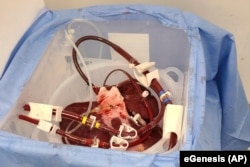 Genetski modifikovana svinjska jetra (Foto: eGenesis via AP)