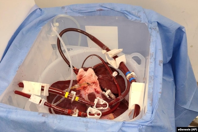 FILE - This photo provided by eGenesis on Jan. 18, 2024, shows a genetically modified pig liver in Massachusetts before transportation to the University of Pennsylvania in Philadelphia in December 2023. (eGenesis via AP)