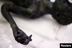The so-called Marcius Grabillo "scrawny boy" bronze, a full-body sculpture of a young Roman apparently suffering from bone disease, is laid out on a table for restoration May 29, 2023. (REUTERS/Guglielmo Mangiapane)