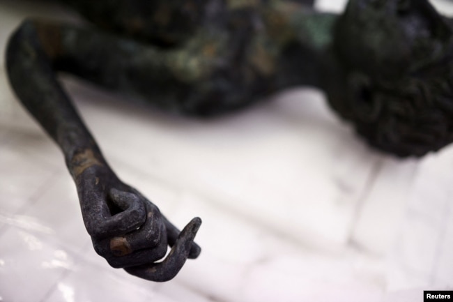 The so-called Marcius Grabillo "scrawny boy" bronze, a full-body sculpture of a young Roman apparently suffering from bone disease, is laid out on a table for restoration May 29, 2023. (REUTERS/Guglielmo Mangiapane)