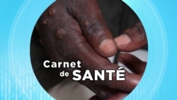  Carnet de Santé : La variole du singe