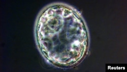A blastocyst, created at Centre for Life in Newcastle upon Tyne, is seen five days after nuclear transfer took place. Scientists at Britain's Francis Crick Institute have removed a gene from a human embryo so that a blastocyst did not form.