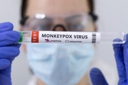 Test tubes labelled "Monkeypox virus positive" are seen in this illustration taken on May 23, 2022. (Dado Ruvic/Illustration/Reuters)