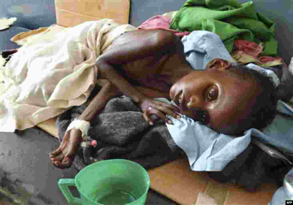 A malnourished child from southern Somalia lies in Banadir hospital in Mogadishu, Somalia, Monday, Aug 15, 2011. The World Food Program said Saturday that it is expanding its food distribution efforts in famine-struck Somalia, where the U.N. estimates th