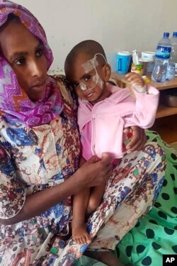 सेलम मुलु, 2, का इलाज 4 अक्टूबर, 2022 को उत्तरी इथियोपिया के टाइग्रे क्षेत्र में मेकेले के आयडर रेफरल अस्पताल में कुपोषण के लिए किया जाता है।
