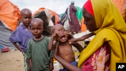 FILE - Maryan Madey, who fled the drought-stricken Lower Shabelle region, holds her malnourished daughter Deka Ali, 1, at a camp for the displaced on the outskirts of Mogadishu, Somalia, Sept. 3, 2022. 