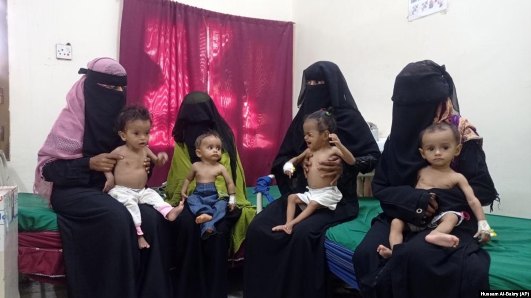 Para ibu menggendong anak mereka yang kekurangan gizi di Rumah Sakit Pedesaan Hays di Hodeida, Yaman, 11 Oktober 2022. (AP Photo/Hussam Al-Bakry)
