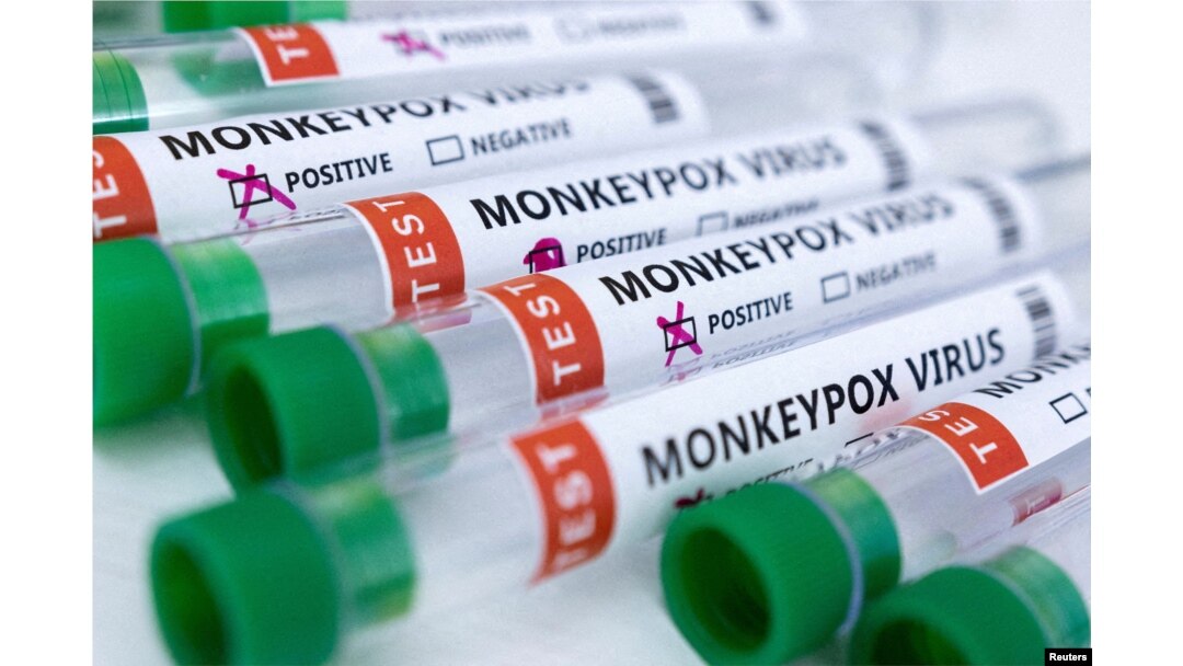 Tabung reaksi berlabel "Virus cacar monyet positif dan negatif", 23 Mei 2022. (Foto: REUTERS/Dado Ruvic)