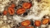 Esta imagen difundida por el Instituto Nacional de Alergias y Enfermedades Infecciosas muestra una imagen captada con un microscopio en el que se ven partículas de viruela símica, en anaranjado, en una célula infectada (marrón), cultivada en un laboratorio. (NIAID via AP)