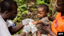 Seorang anak terinfeksi cacar monyet, dipangku ayahnya saat dirawat di pusat LSM medis Internasional Doctors Without Borders (MSF), di Zomea Kaka, wilayah Lobaya, Republik Afrika Tengah, 18 Oktober 2018. (CHARLES BOUESSEL / AFP)